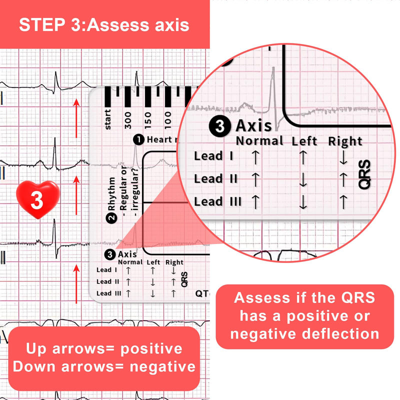 ECG Ruler, ECG 7 Step Ruler, ECG 7 Step Ruler for ECG/EKG Interpretation, Transparent EKG Calipers Measuring Tool, Follow a 7 Step Plan, Portable ECG Assessment Tool EKG Card