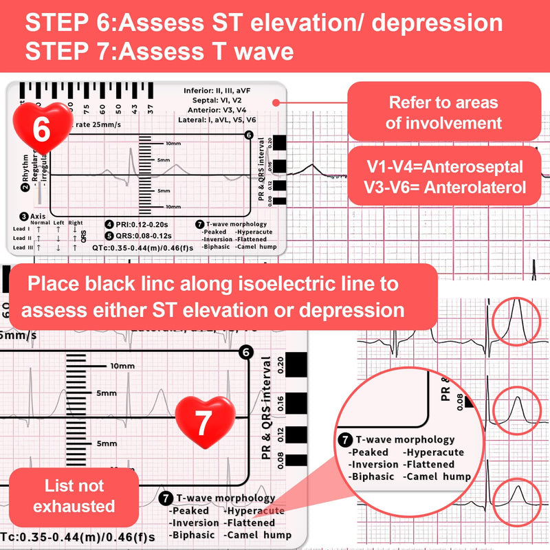 ECG Ruler, ECG 7 Step Ruler, ECG 7 Step Ruler for ECG/EKG Interpretation, Transparent EKG Calipers Measuring Tool, Follow a 7 Step Plan, Portable ECG Assessment Tool EKG Card