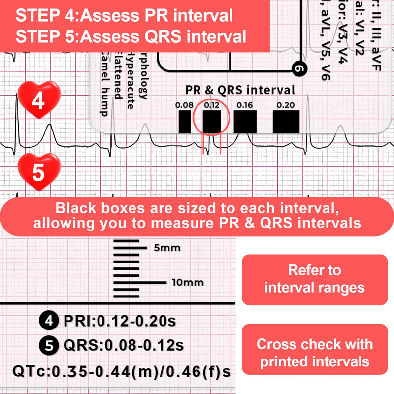 ECG Ruler, ECG 7 Step Ruler, ECG 7 Step Ruler for ECG/EKG Interpretation, Transparent EKG Calipers Measuring Tool, Follow a 7 Step Plan, Portable ECG Assessment Tool EKG Card