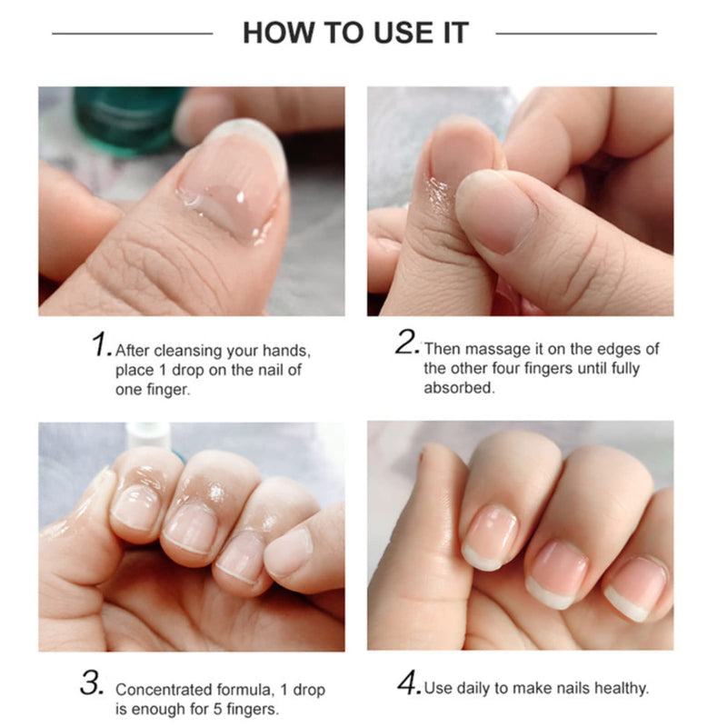 Nail Cuticle Oil 15ml with Organic Vitamin E & B, Cuticle Oil for Nails, Jojoba Nail Cuticle Oil,Nail Oil Soothe Moisturize with Dropper Design for Dry Rough Nail Care Repair - NewNest Australia