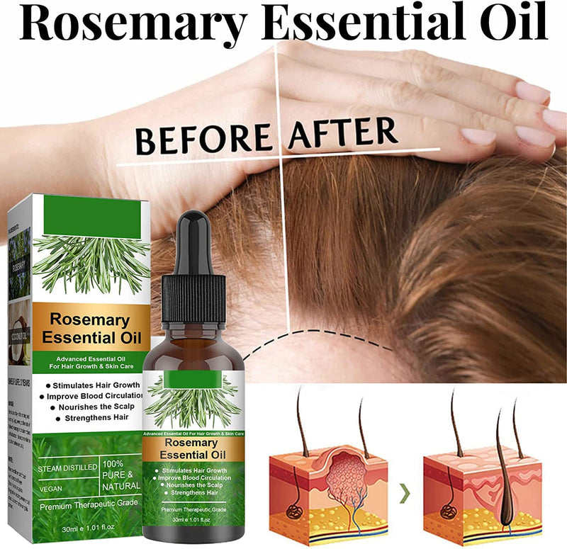 Rosemary Essential Oil, Rosemary Essential Oil, Rosemary Oil Hair Growth, Rosemary Oil 100% Natural Organic Essential Oil, Strong Hair Growth, More Hair Density, Hair Growth 2 X 30 Ml (60 Ml) - NewNest Australia