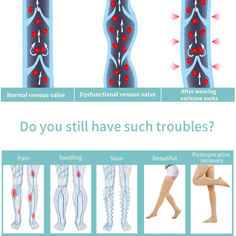 Evolyline Medical Open Toe Thigh High Compression Socks for Women & Men, Beige Compression