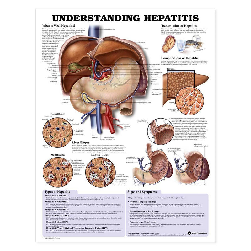 Understanding Hepatitis Anatomical Chart