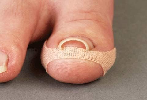 Cyprus Nail Tape Kui Komanai x 3 Piece Set - NewNest Australia