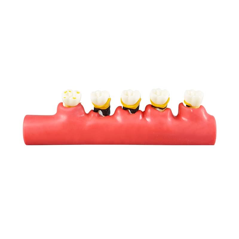 Global-Dental Model Periodontal Classification Model Periodontal Disease Model Dentist-Patient Communication Display Model