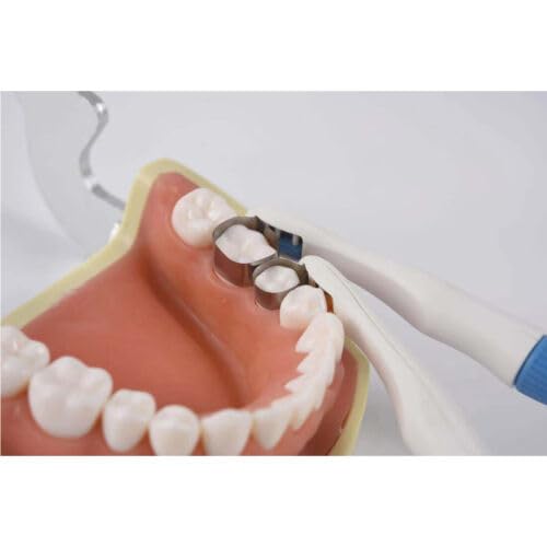 Dental Pro Matrix Bands Metal Molar/Premolar Restoration Band Adjustable 10Pcs (6MM Curved) 6MM Curved