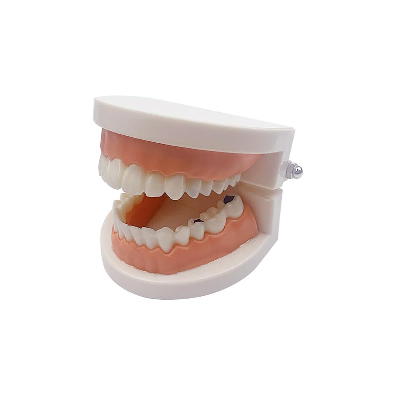 Decay Tooth Model, YOUYA Dental Caries Standard Teeth Teaching Model Study Tool Adult Disease Standard Typodont Demonstration Teeth Model for Kids Oral Care Teaching