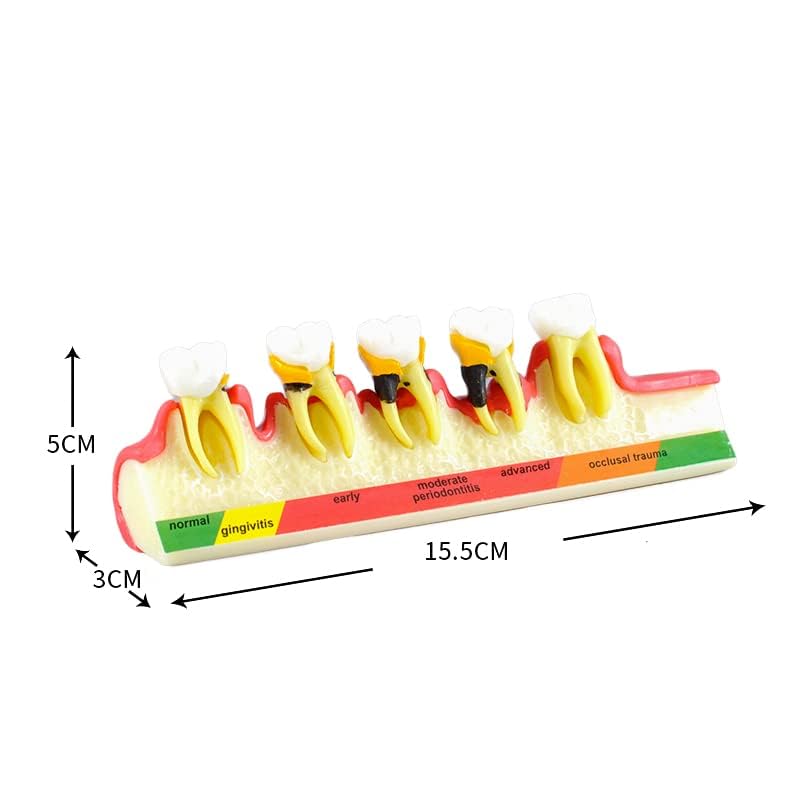 Global-Dental Model Periodontal Classification Model Periodontal Disease Model Dentist-Patient Communication Display Model