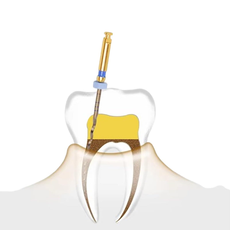 Dental Endo Rotary File X-Pro Gold Taper 6PCS Niti Endodontic Root Canal Files (31MM Assort) 31MM Assort