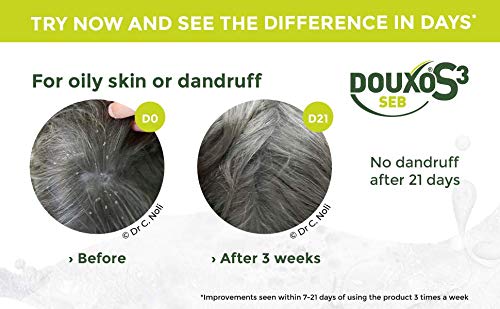 DOUXO S3 SEB Mousse, Dog & Cat Dandruff Solution, Soothing Leave-On Cat Mousse, Effective Mousse for Dog Dermatitis, Flaky & Oily Pet Skin, Hypoallergenic Fragrance, Dog Dandruff Mousse, 150ml - PawsPlanet Australia