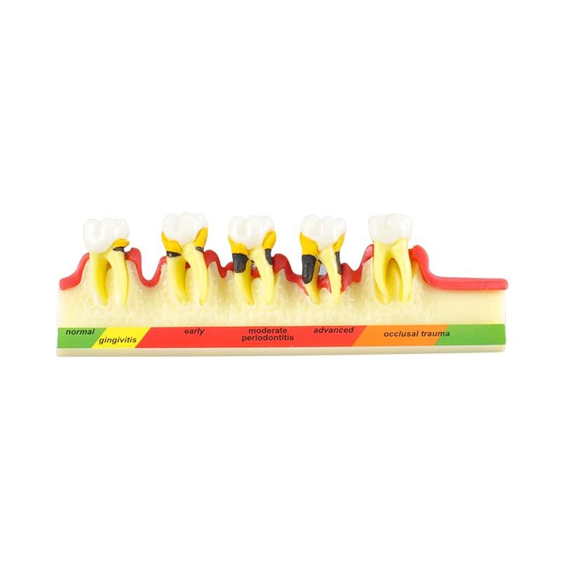 Global-Dental Model Periodontal Classification Model Periodontal Disease Model Dentist-Patient Communication Display Model