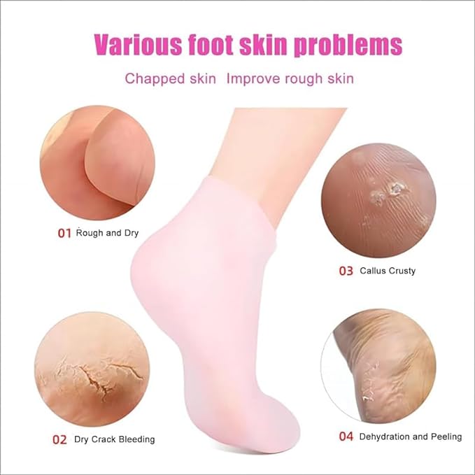 Silicone Socks, Moisturizing Gel Socks, Heel Care, Socks, Moisturizing, Exfoliating Care, Prevents Cracks, Prevention, Protection, Pain Relief, Stretch, Cracking, Cracking, Unisex, White - NewNest Australia