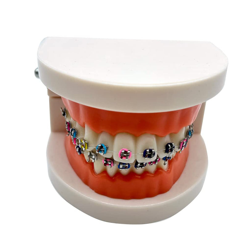 Dental Orthodontic Demonstration Model with Metal Bracket,Arch Wire Standard Teeth Model with Braces (Brackets) Brackets