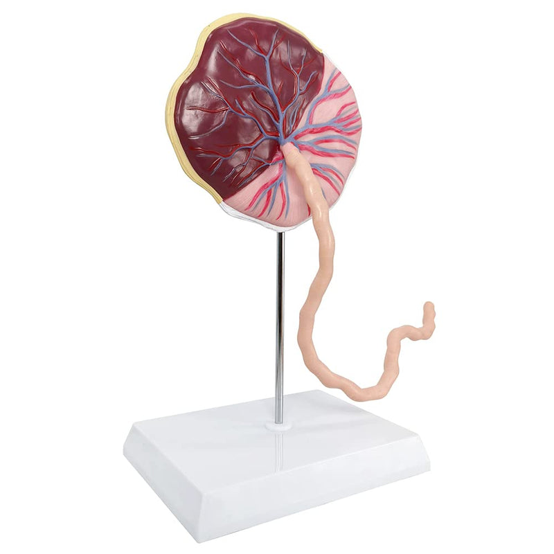 Placenta Umbilical Cord Anatomical Model, Life Size Umbilical Cord Placenta Model with Veins Arterial Embryo Tissue Structure for Obstetrics and Gynecology Teaching Tool with Base