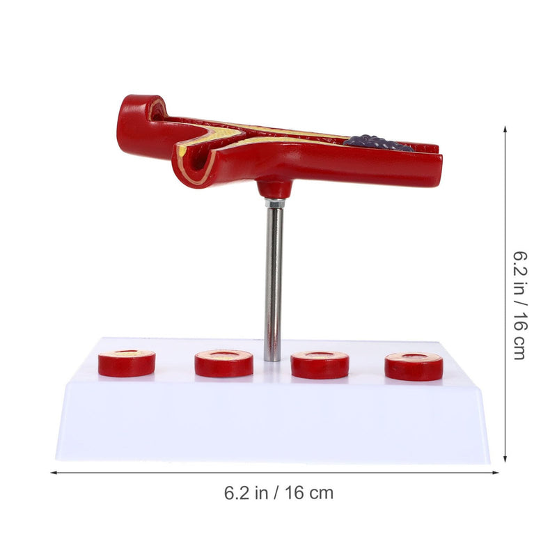 Model Cardiovascular Model Blood Vessel Anatomy with Plaque for Education Teaching Anatomy Display 7.08 X 6.29 X 5.11 in