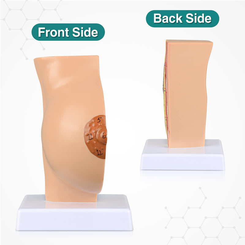 Ultrassist Non-Lactating Breast Model, Human Anatomy Model， Breast Anatomical Model with Study Card for Doctor Surgeon Gift Non-Lactating Breast Sagittal Section Model