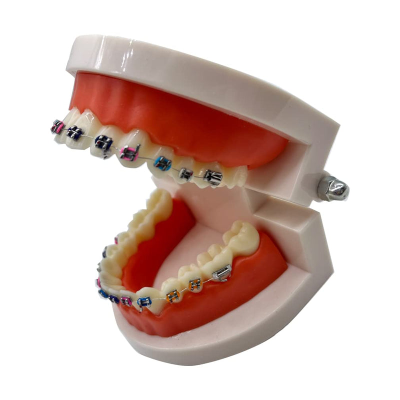 Dental Orthodontic Demonstration Model with Metal Bracket,Arch Wire Standard Teeth Model with Braces (Brackets) Brackets
