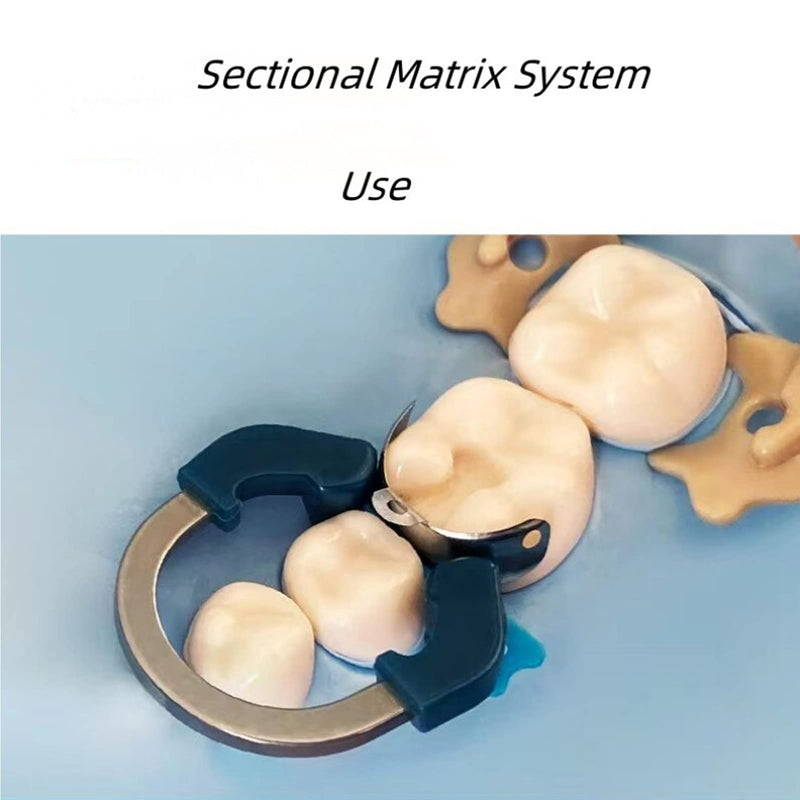 Dental Sectional Matrix Ring Clamp Spring Clip, Autoclavable Nickel Titanium Orthodontic Clamp Rings, Contoured Matrices System for Pre and Post Molars. (R6 QIANLV) R6 QIANLV