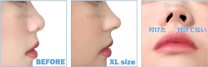 CatMoz 3D Nose Petite 5 Sizes, Improve Dumpling Nose, Pig Nose, Garlic Nose, Pain Free Orthopedic Nose, Box of 2 Sizes (LXL, 2 Sizes) - NewNest Australia