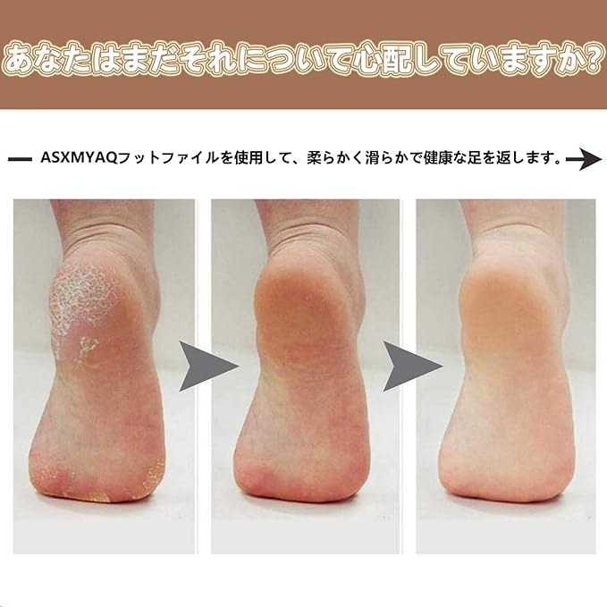 ASXMYAQ Foot File Exfoliating Remover Foot Scraper Pedicure Tool Stainless Steel Foot Slap Heel Exfoliating Exfoliating Exfoliating Foot File Exfoliating Remover for Sharpening, Travel, Wet and Dry Feet - NewNest Australia