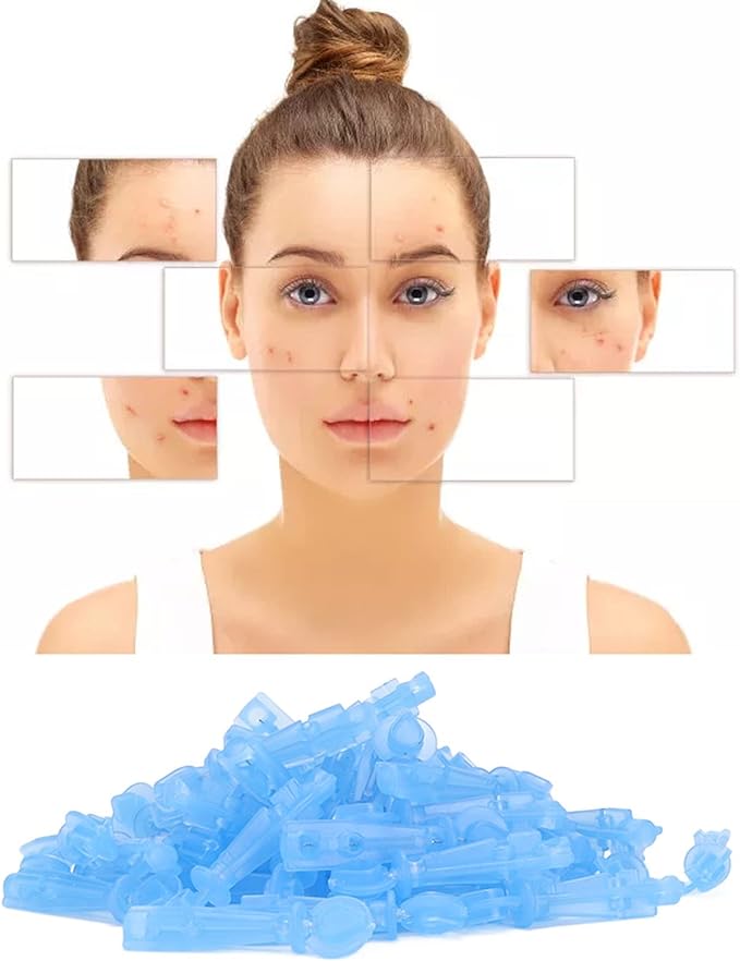 Raqz Blackhead Removal Tool Easy Operation Acne Needles ABS Material - NewNest Australia