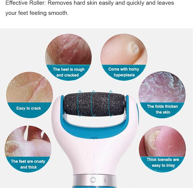 Amope Pedi Replacement Roller 12 Pack Electronic Perfect Foot File (6 Pre-Roughness & 6 Regular Roughness) - NewNest Australia