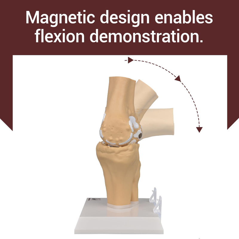 1:1 Osteoarthritis Knee Model for Orthopedic Patient Education | Shows Knee Arthritis;Explains Cartilage Wear;Magnetic Demo Design;For Clinic Teaching;Patient Education Aid