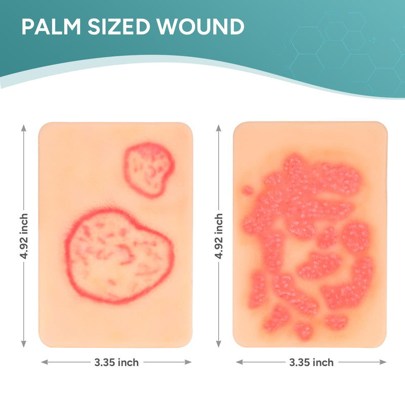 Wound Packing Trainer,Fungal Infection Wound Model, Palm Sized Wound Simulation Models for Medical Education, Wound Care Demonstrations Tool, 2PCS