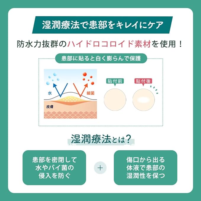 KIWAMI ByeByeNIKIBI Acne patches, 56 pieces, general medical equipment, CICA combination, moisture therapy, hydrocolloid material, tea tree, UV protection - NewNest Australia