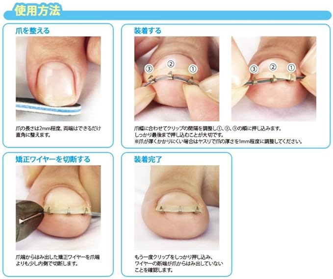 JPS New Intrusion Nail Lift with File (Winding Nail Lift, Set of 2) - NewNest Australia