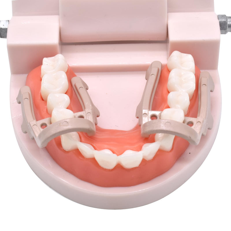Angzhili 2pcs Distal-Extension Dental Dam Clamp,Rubber Sheets Barrier Clips,Dentistry Material Teeth Repair Tools,Long Size and Short Size