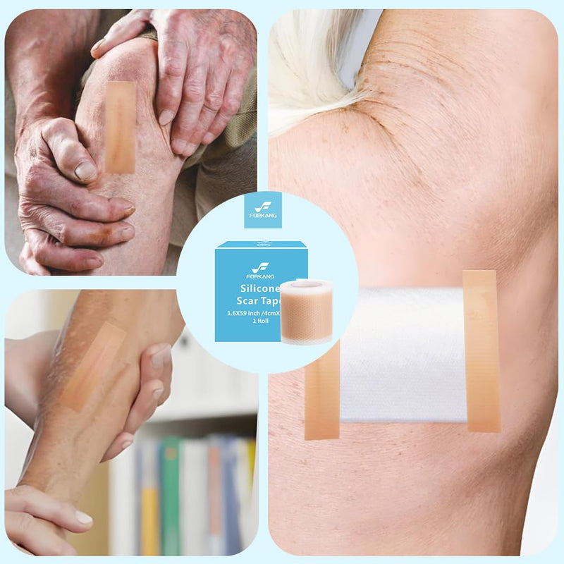 Silicone Scar Sheets Roll (1.6” x 59” - 1.5M) | Medical Grade Scar Tape for Surgery, C-Section, Burns & Keloids | Reusable Silicone Scar Strips | Professional Scar Treatment for Acne, Surgical Scars