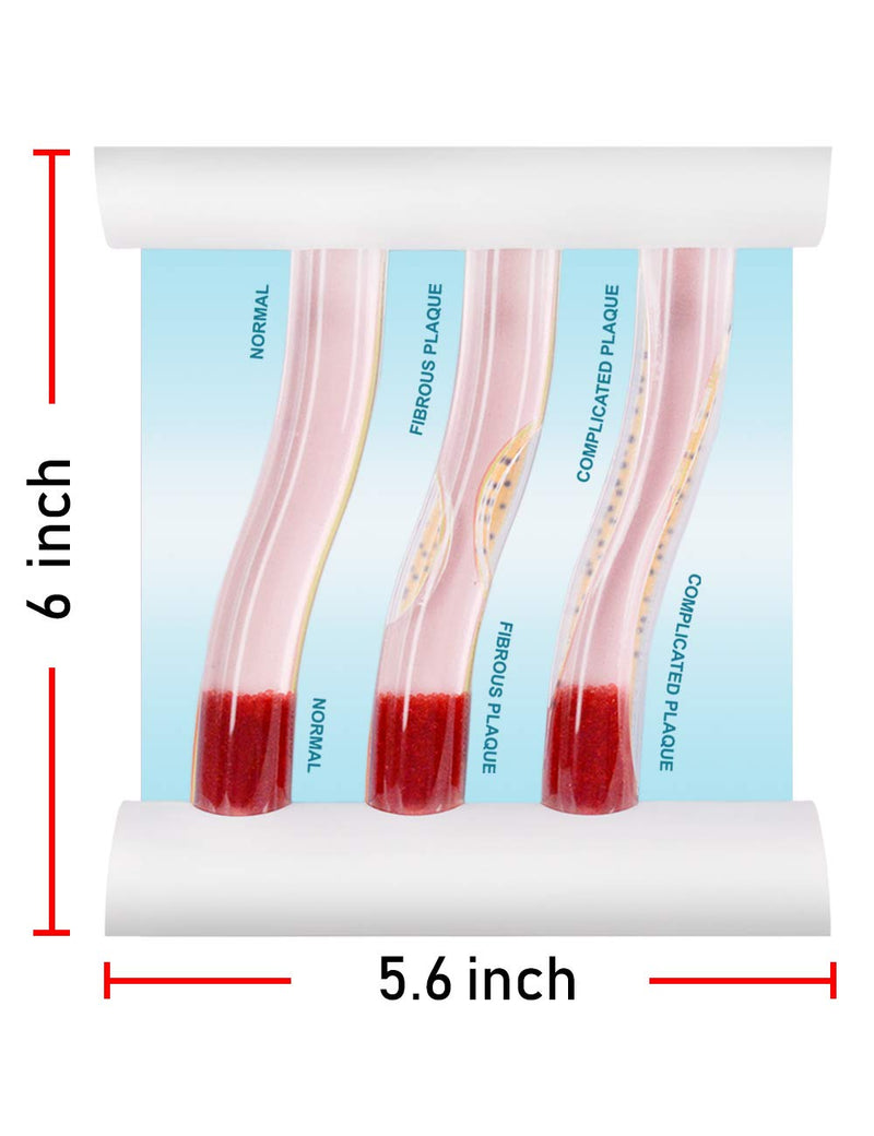 Medarchitect Low-Density Lipoprotein LDL Blood Vessel Model for Medical Patient Doctor Teaching