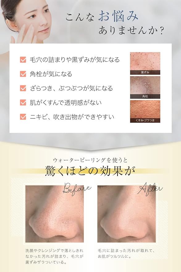 RELX Water Peeling Facial Beauty Device Ultra Lightweight 2.4 oz (70 g) (Japan Manufacturer) Multi-functional Facial Beauty Device Ultrasonic EMS Ion Peeling Cleansing Pore Care Blackhead Gift (Rose - NewNest Australia