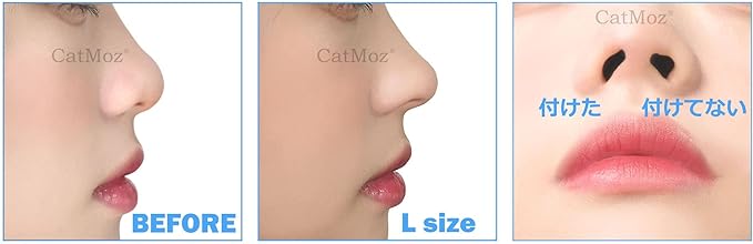 CatMoz 3D Nose Petite 5 Sizes, Improve Dumpling Nose, Pig Nose, Garlic Nose, Pain Free Orthopedic Nose, Box of 2 Sizes (LXL, 2 Sizes) - NewNest Australia