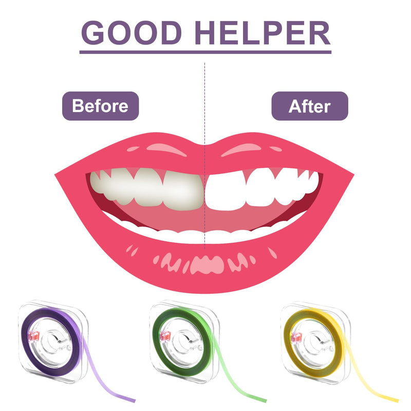 3pcs Dental Polishing Strips, Teeth Sanding Grinding Tool Tooth Polish Abrasive Strip Tooth Polishing Kit Teeth Abrasive Finishing Strip Teeth Cleaning Tool Dental File for Teeth