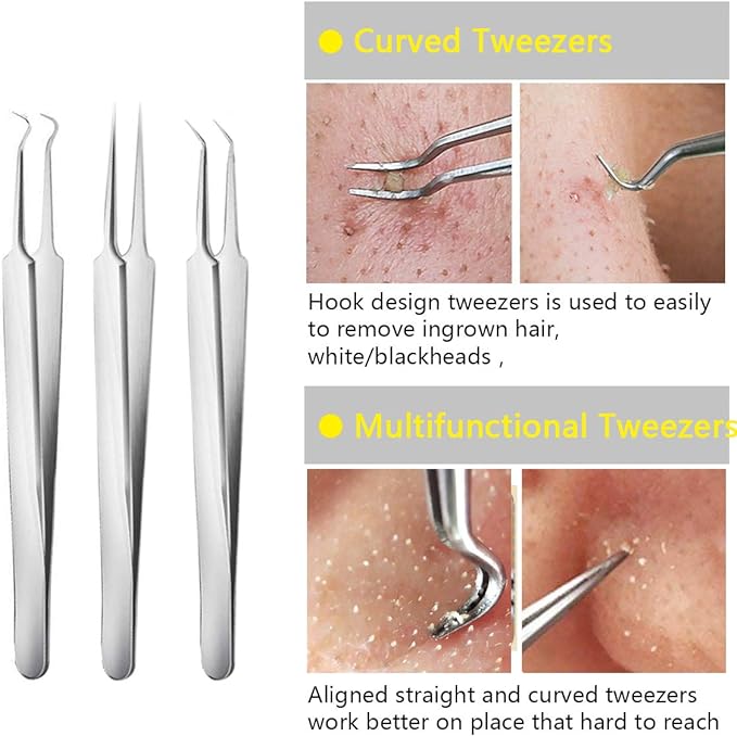 Aooeou Facial Scars Whitehead Cure Pores Blackhead Removal Acne Tool 9 Piece Kit Pro Stainless Steel Curved Acne Tweezers Comedone Extractor Tool Set 1 Back Acne Popper Tool 9 Acne Popper Tool - NewNest Australia