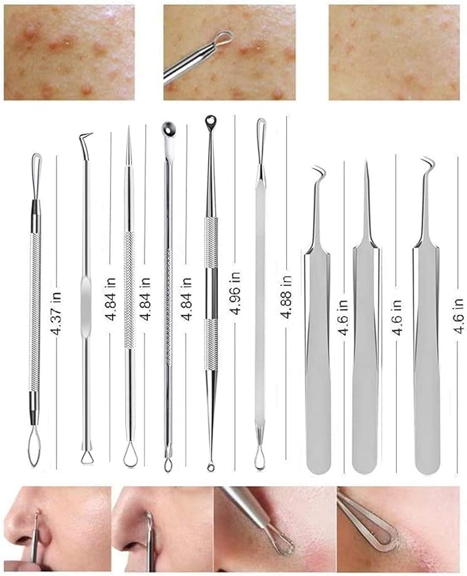 Aooeou Facial Scars Whitehead Cure Pores Blackhead Removal Acne Tool 9 Piece Kit Pro Stainless Steel Curved Acne Tweezers Comedone Extractor Tool Set 1 Back Acne Popper Tool 9 Acne Popper Tool - NewNest Australia