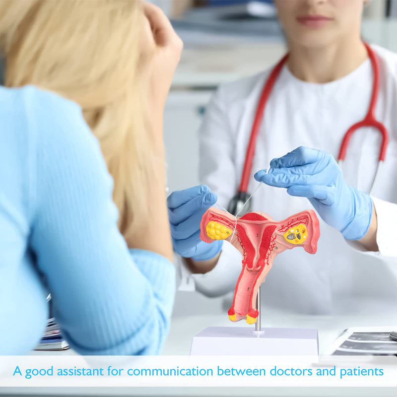 ANNWAN Female Ovary Model - Life Size Human Uterus and Ovary Model Female Reproductive Organ Model for Studying and Communication