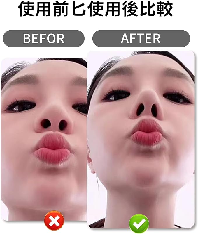 nalaina 3D Nose Pinch Nose Clip, Nose Clip, Highly Flexible, High Nose, Beautiful Nose, Small Nose, Easy, Painless, Dumpling Nose or Pig Nose, Unisex, Set of 3 Sizes - NewNest Australia