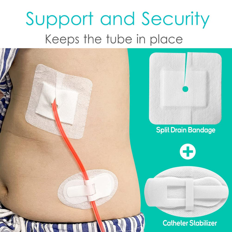 Feeding Tube Pads for Peritoneal Dialysis Peg/G/J Tube Stabilizer Accessories PD Abdominal Support Holder Patch Individually Packed Adhesive Stickers for Elderly Man Woman (Pack of 10) Catheter Stabilizer Adults-10 Pcs