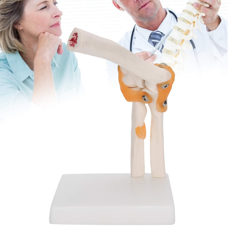 Elbow Joint Model, Elbow Joint Model Life Size Accurate Elbow Skeleton Model Boned Shoulder Joint Model for Study Display Teaching