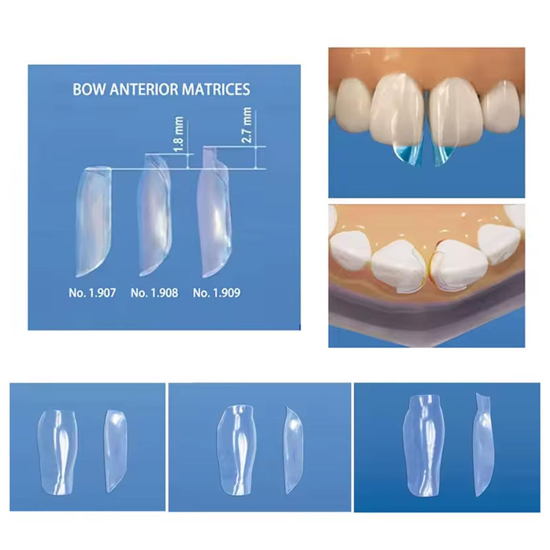 Dental Clear Matrix Anterior Matrice, BT Anterior Matrices Bioclear Style, Transparent Bow Anterior Matrices Sectional Contoured Matrix System (3, S/L/M) 3