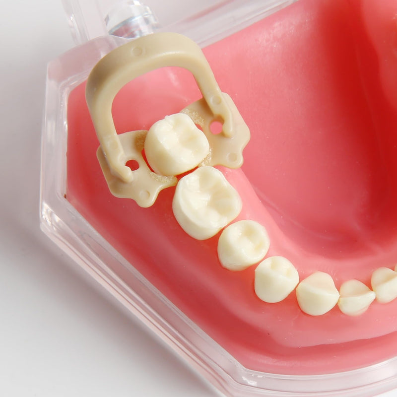 Dental Sectional Matrices Clip Dam Clamps Resin Rubber Barrier Clip Z1/Z2/Z4 Mixed Molar Teeth Repair Tools 6Pcs