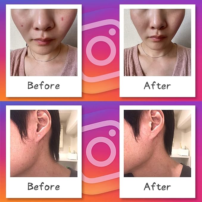 (Round Size) Foundation Tape, 30 Pieces of 5 Sheets, Milky Beige, Hide Moles, Conceal Piercings, Conceal Stains, Stickers, Face, Ears, Made in Japan, Login My Life - NewNest Australia