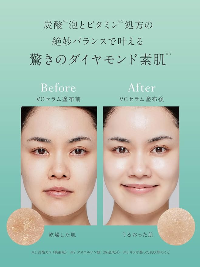 Dr. Syuwan | Micro Bubble VC Serum, Introduction Serum, Carbonated Serum, Moisturizing, Pores, Vitamin c Lotion - NewNest Australia