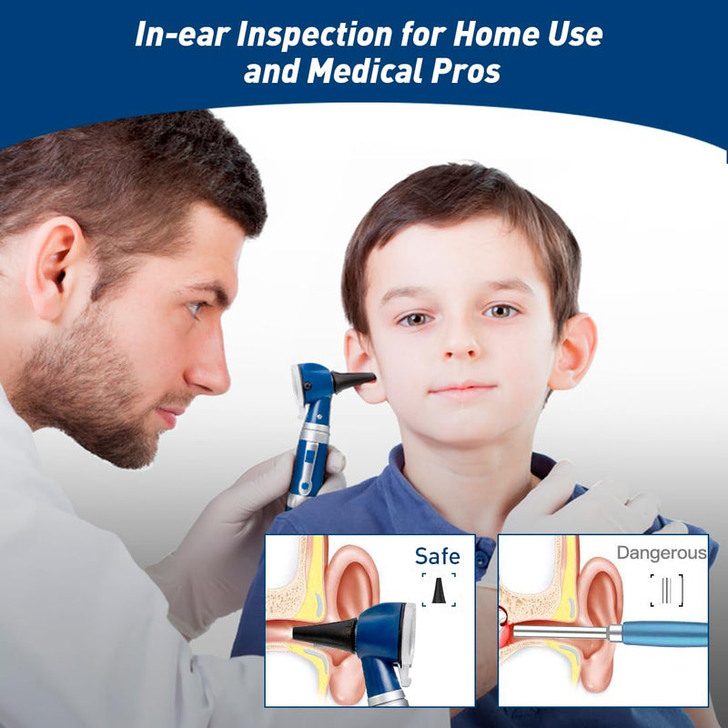 Scian Otoscope - Ear Scope with Light, Fiber Optic Otoscopes with Hard Plastic Case, Pocket Diagnostic Ear Infection Detector for Kids Adults Home Use (Blue) Blue