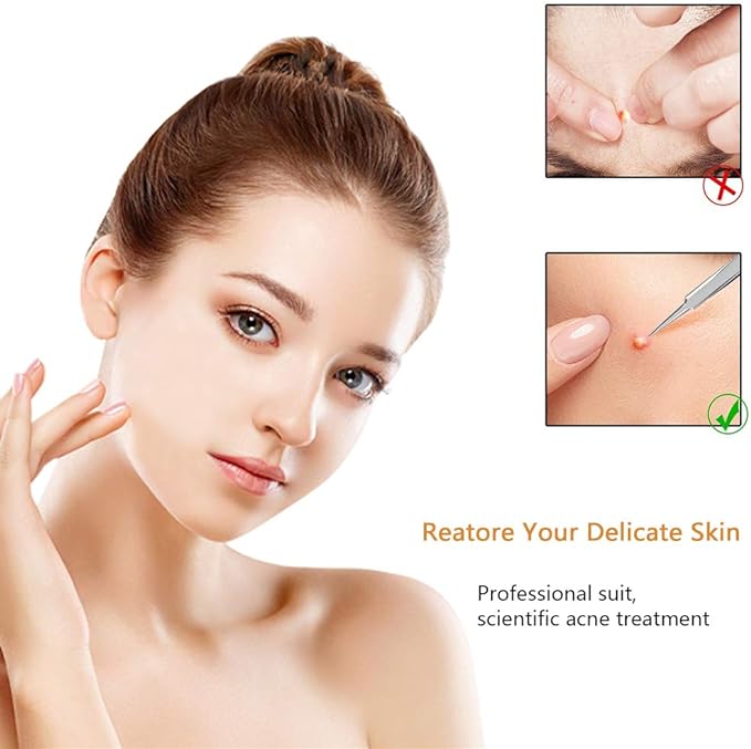 Aooeou Facial Scars Whitehead Cure Pores Blackhead Removal Acne Tool 9 Piece Kit Pro Stainless Steel Curved Acne Tweezers Comedone Extractor Tool Set 1 Back Acne Popper Tool 9 Acne Popper Tool - NewNest Australia