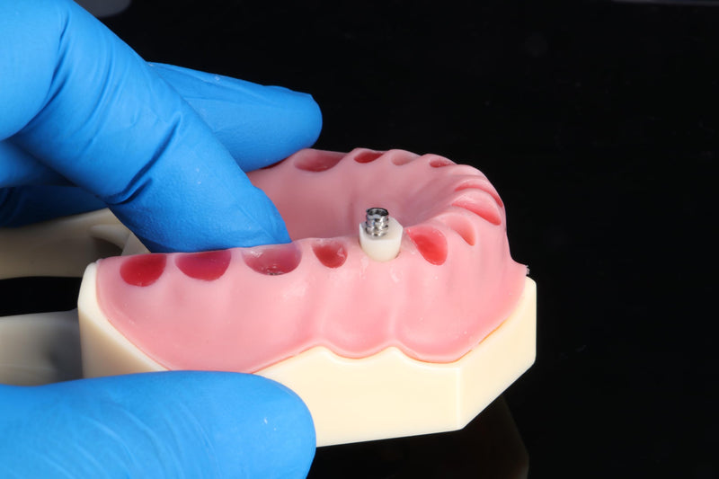 Emergence Profile Silicone Index Organizer Block – Dental Implant Natural Emergence Profiler, Autoclave Safe, Universal Compatibility