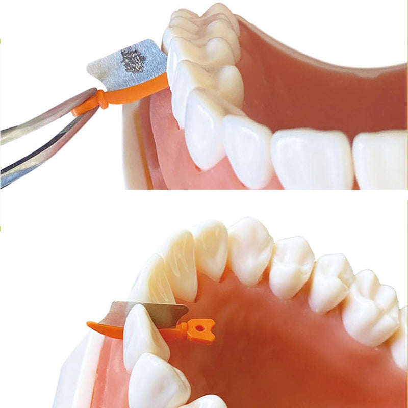 Dental Wedge Knife, Dental Interproximal Plastic Wedge, Dental Wedge Guard with Metal, Dental Plastic Wedges Orthodontic Matrix Wedges for Teeth Interproximal Area. (72PCS) 72PCS